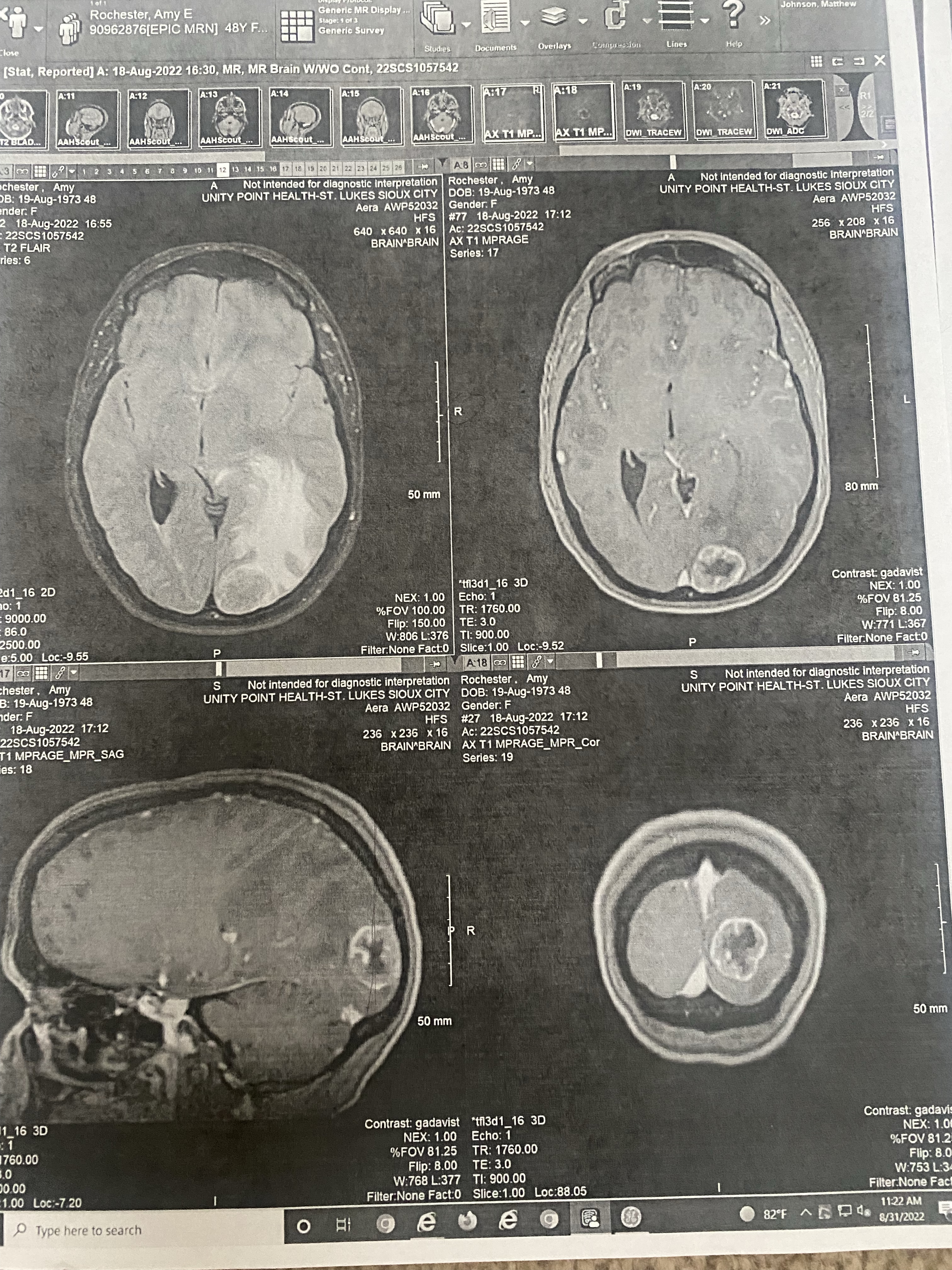 Chemo and Radiation- Real Faith vs. Denial.